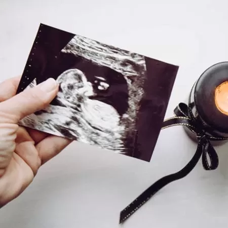 Luto Perinatal Luto Perinatal